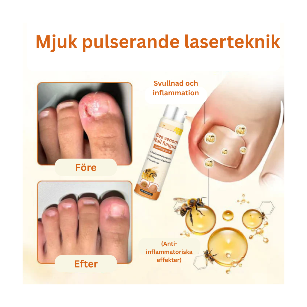 Propofix™ | Hjälper till att minska nagelsvamp och förbättra naglarnas utseende på upp till 7 dagar.
