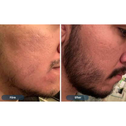 HårVäxt™ – Minoxidil lotion 5 % (1 månads förråd)