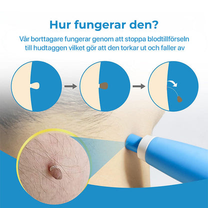 HudFix™ – Hudfliksborttagare